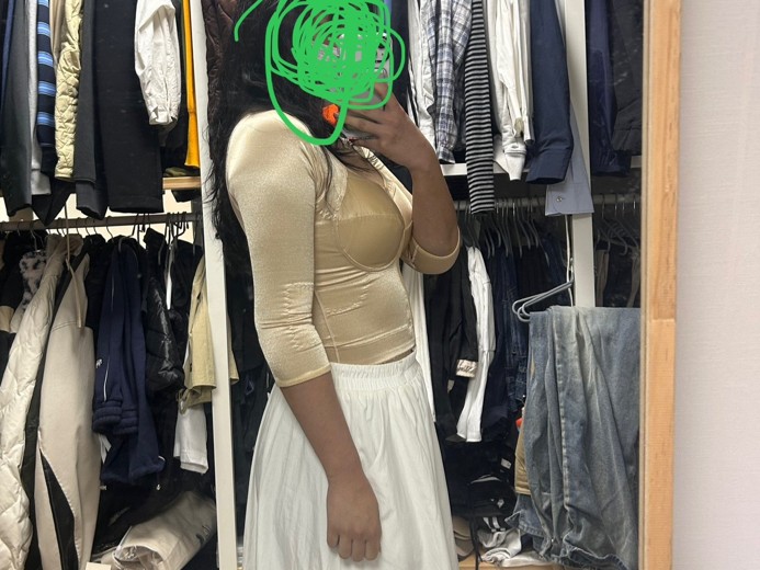 after photo: 팔지방흡입