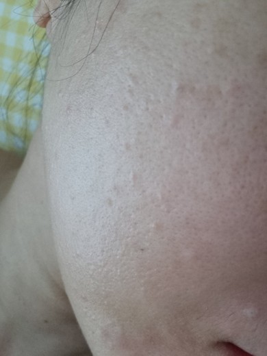 after photo: 엘라비에리투오