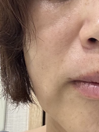 after photo: ボルニューマ