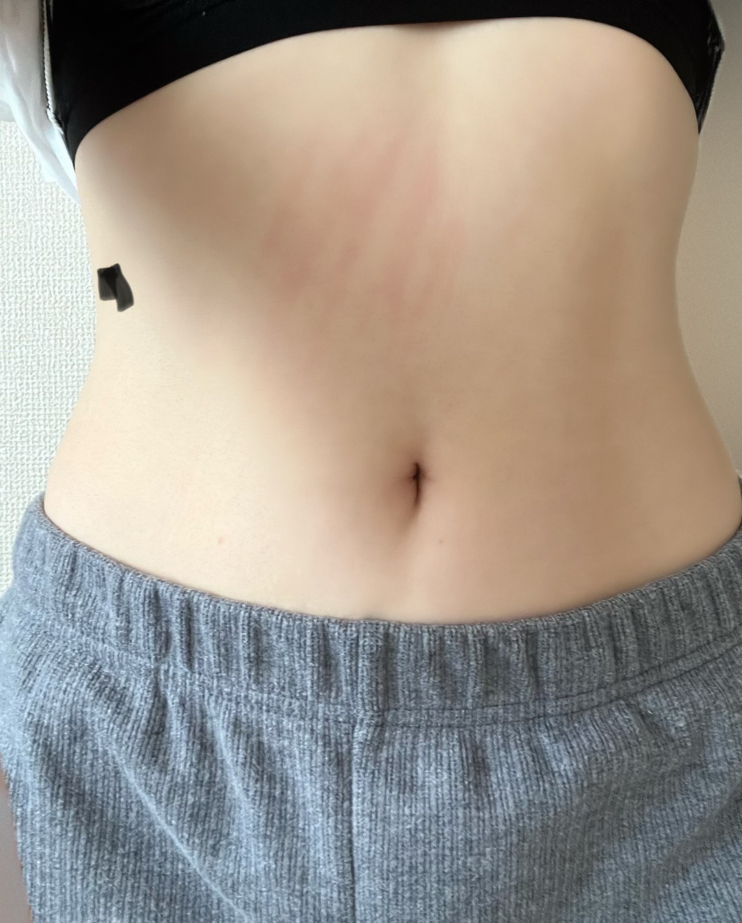 スノエル（脂肪冷却）2パーツ4ハンドル 部分痩せしたい方◎ | オルタ