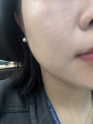 before photo: 쥬베룩