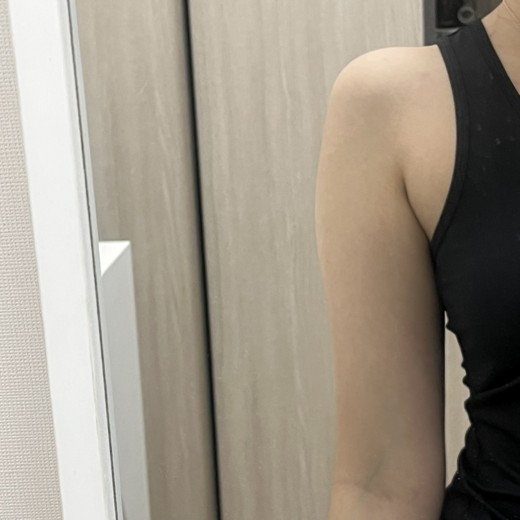 after photo: 팔지방분해주사