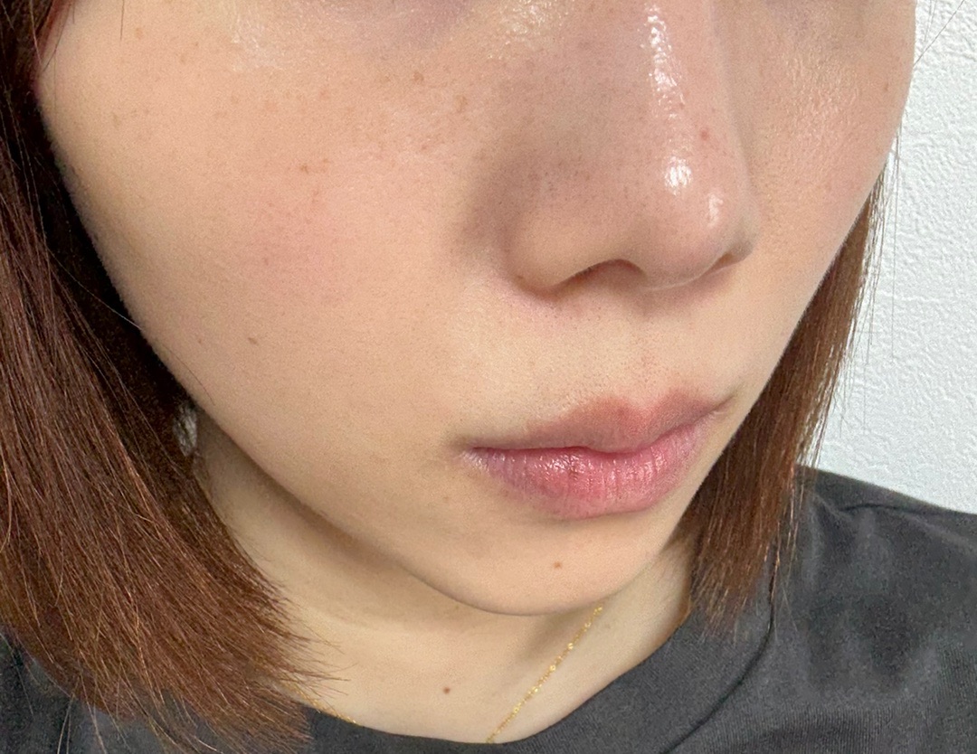 再来OK】ヴェルベットスキン 全顔 | MINIMUM SKIN CLINIC