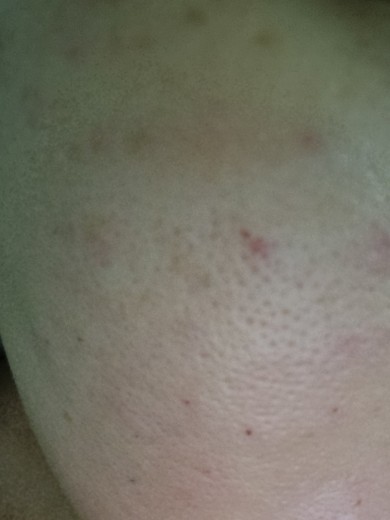 after photo: 엘라비에리투오