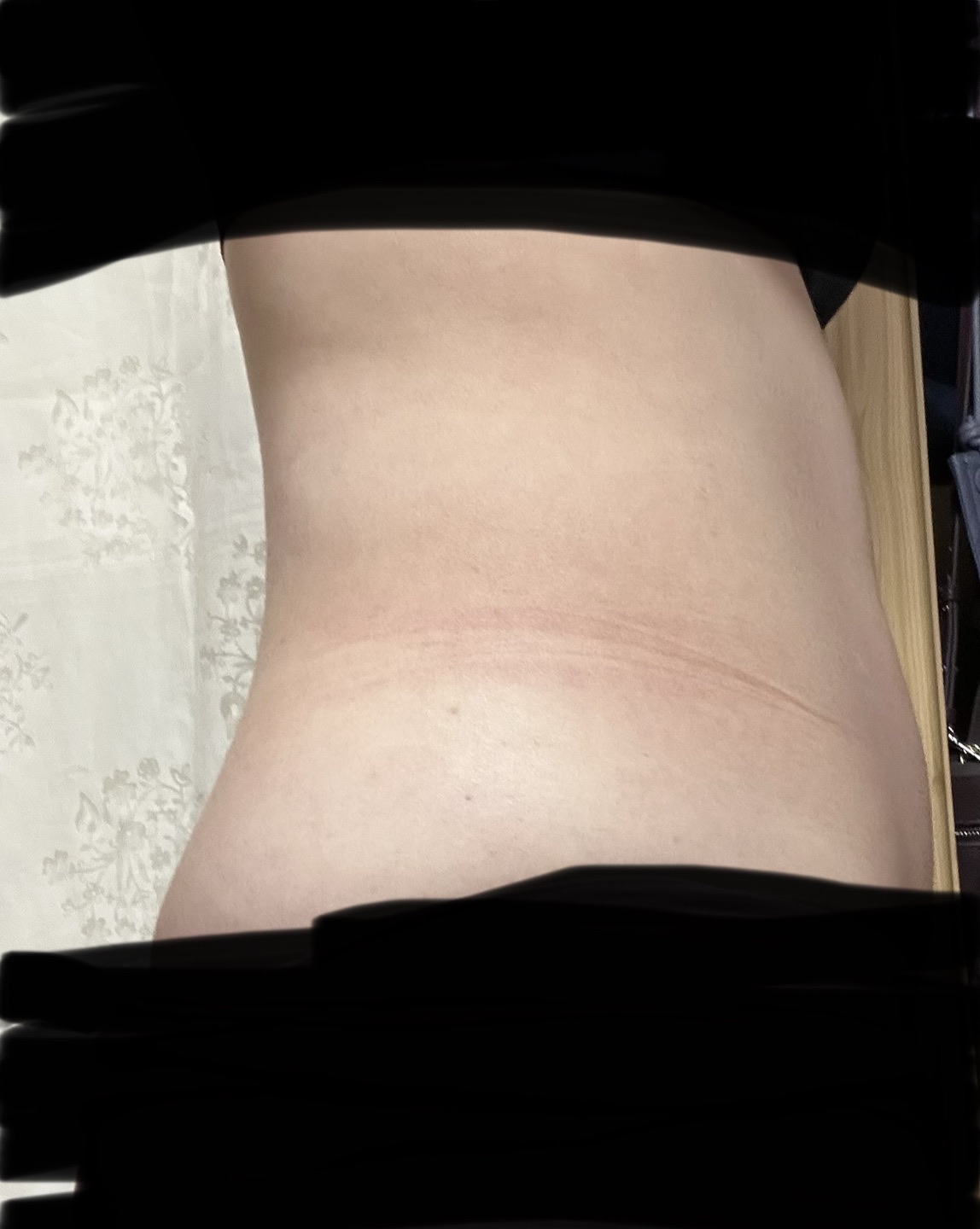 いまだけキャンペーン！冷却　脂肪冷却 2ハンドル いまだけキャンペーン！冷却 脂肪冷却 2ハンドル いまだけキャンペーン