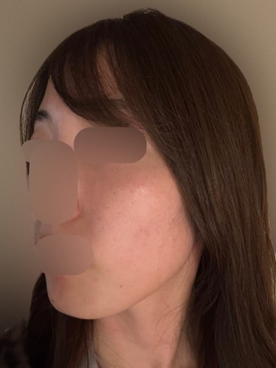 after photo: ルメッカ