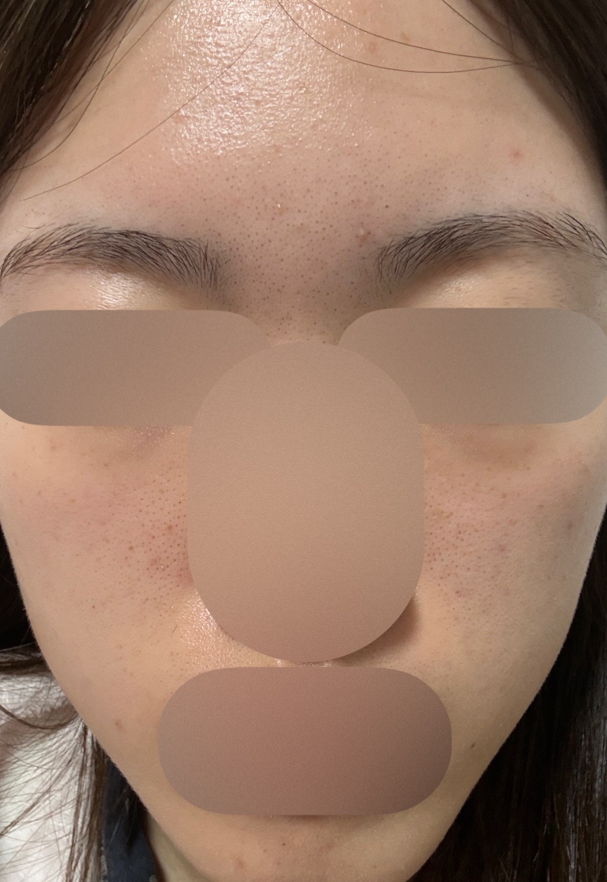 ZX-CLINIC【ゼクスクリニック】の施術口コミ1185件