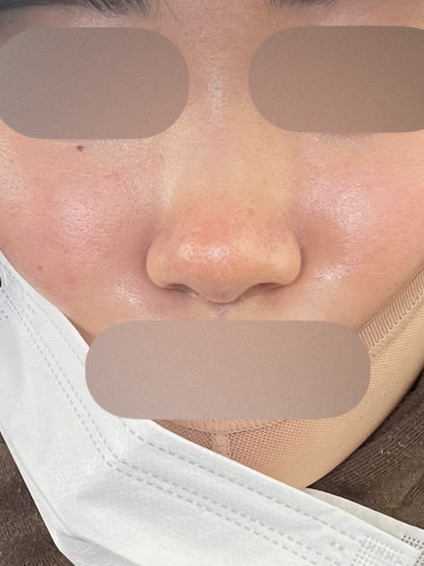 リジュラン 2cc | Karis Beauty Clinic