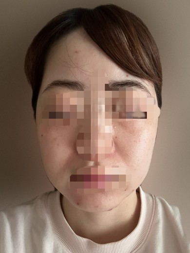 after photo: 診断・検査