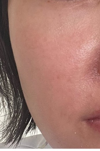 before photo: 白玉注射・点滴