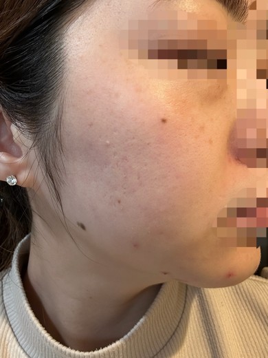 after photo: 診断・検査