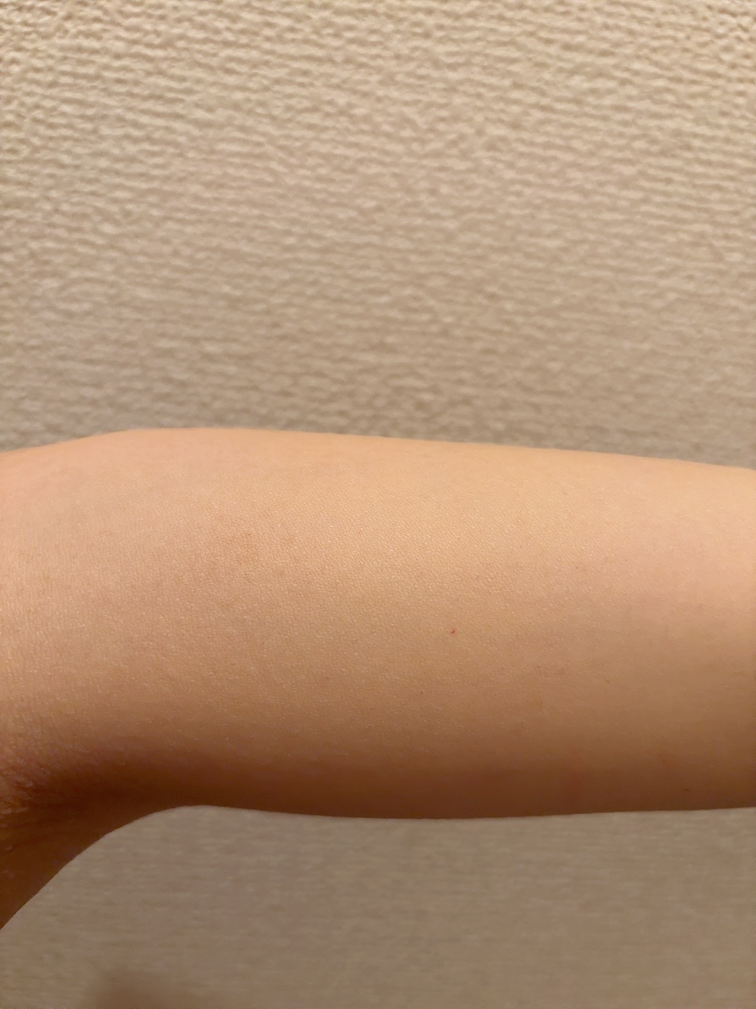何度でも可】両腕脱毛セット｜ジェントルマックスプロ／ジェントル