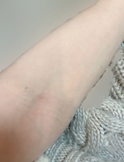 before photo: 白玉注射・点滴, 美容注射・点滴