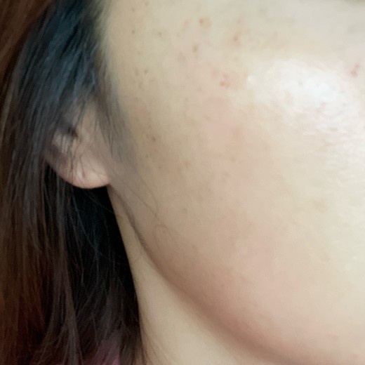 after photo: ルメッカ
