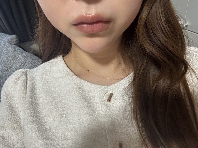 after photo: リニアファーム(ハイフ)