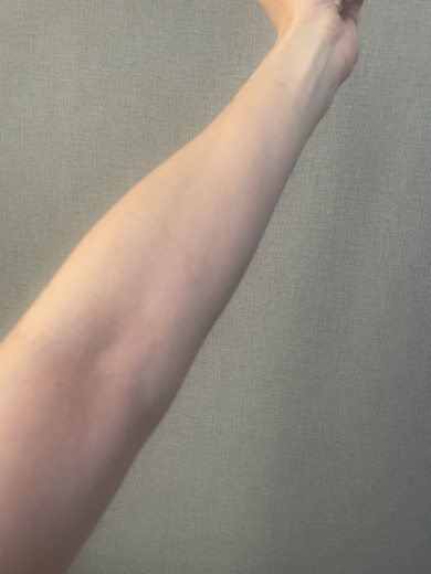 after photo: 白玉注射・点滴