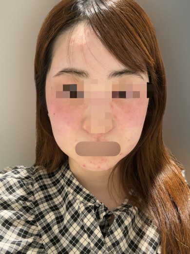 after photo: 診断・検査