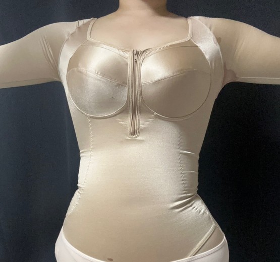 after photo: 전신지방흡입