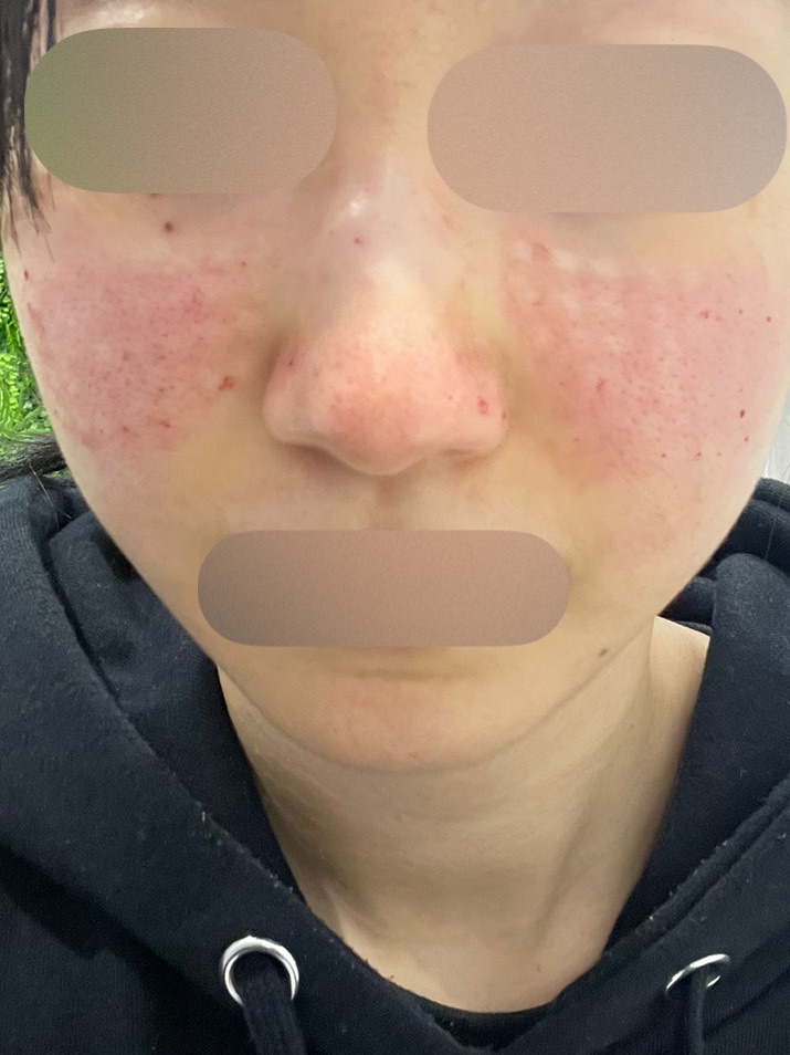 ご縁ある方にお譲りします！様REJURAN ×2本、stem cell 1本 ご縁ある方にお譲りします！様REJURAN ×2本、stem cell 1本 リジュラン