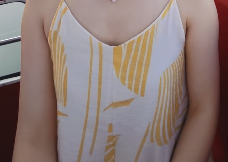 before photo: 가슴(보형물)