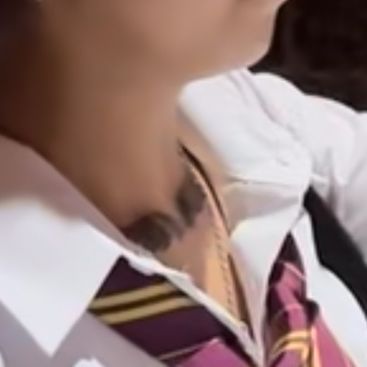before photo: 脂肪溶解注射(顔)