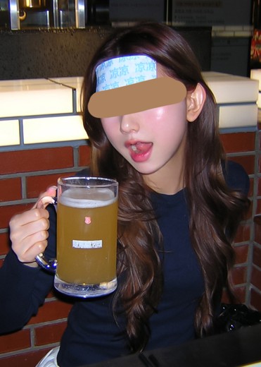 after photo: チューンフェイス(リフトアップ), 脂肪溶解注射(顔)