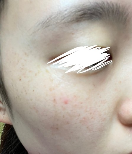 after photo: ルメッカ
