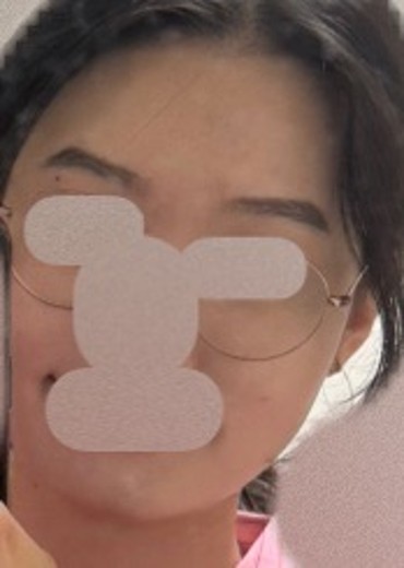 before photo: 소노케어