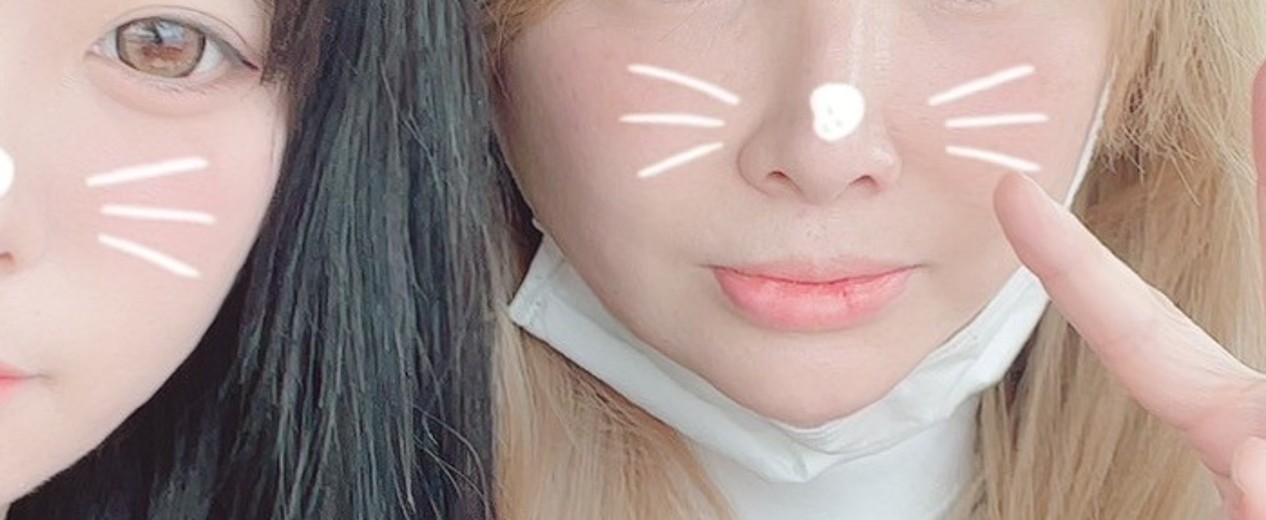 before photo: 입술축소술