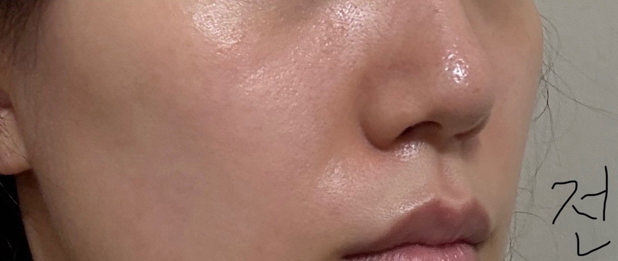 before photo: 쥬베룩