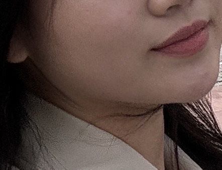 시술 전