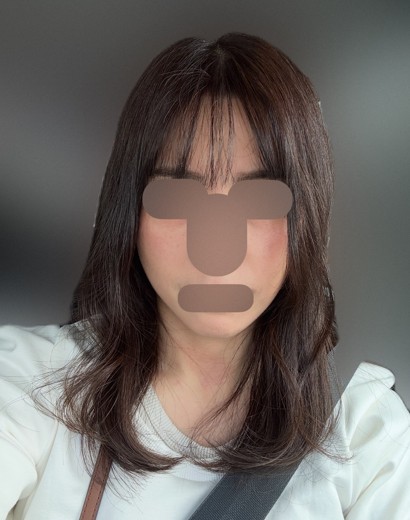 after photo: インモード