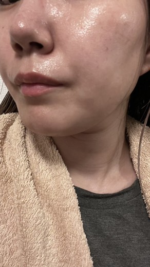 after photo: ジュベルック(Juvelook)