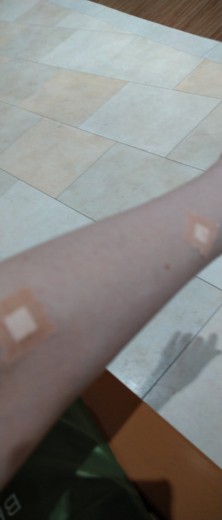 after photo: 白玉注射・点滴, ビタミン注射・点滴
