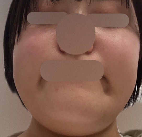 before photo: ルメッカ