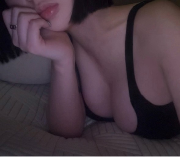 after photo: 가슴(보형물)