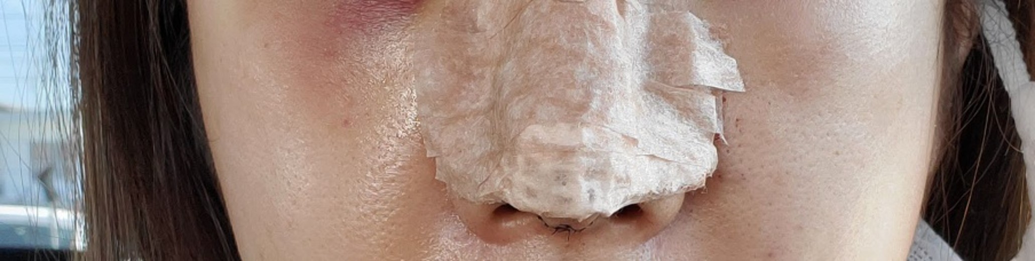 ヴェリテクリニック大阪院の施術口コミ113件, image size:2061x520