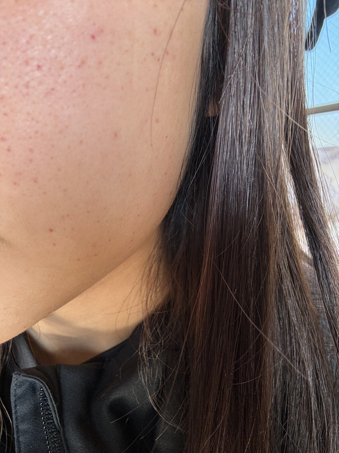 「ciao」リジュランスキンブースター　美容液 フーズフー皮膚科/リジュラン/お肌管理/お肌ツルツル | ♥韓国の