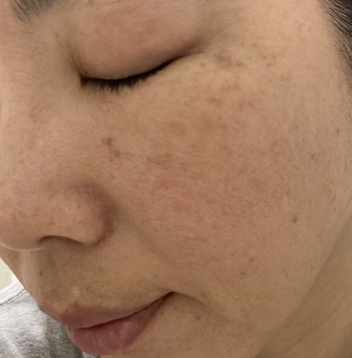after photo: ルメッカ