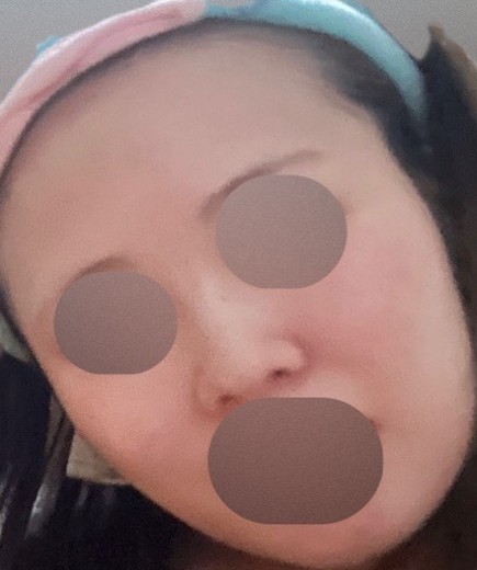 before photo: ルメッカ