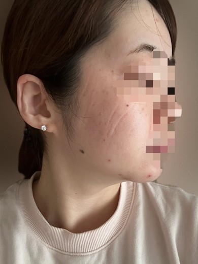 after photo: 診断・検査