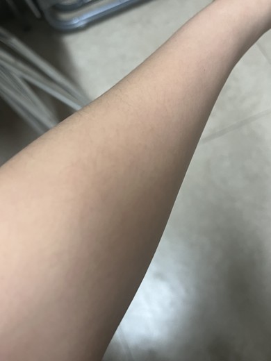 before photo: 팔제모