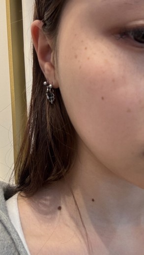 before photo: 레이저토닝