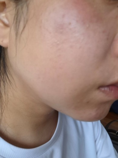 before photo: ルメッカ
