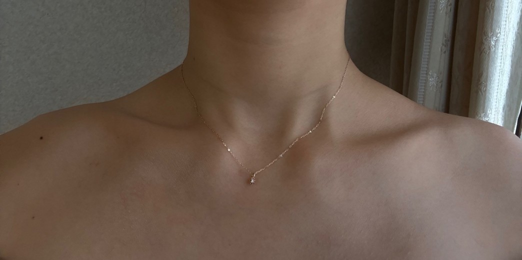 after photo: 肩ボトックス(僧帽筋)