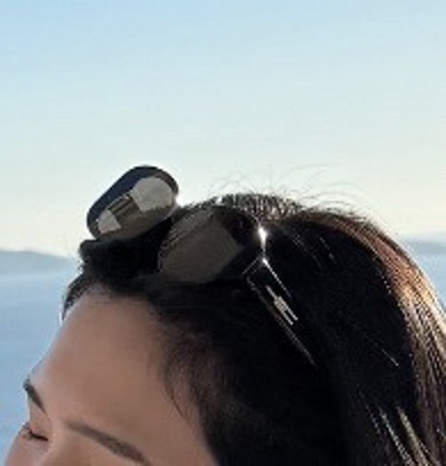 before photo: 이마필러