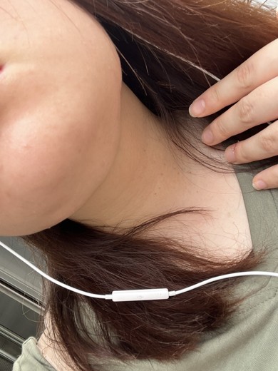 after photo: 脂肪溶解注射(顔)