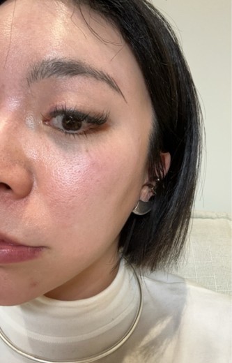 before photo: ジュベルック(Juvelook)