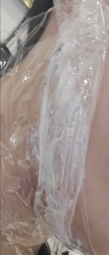 before photo: 윤곽주사