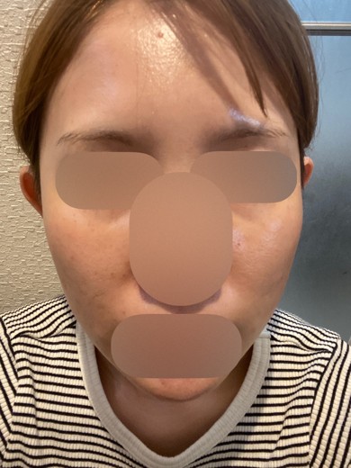 after photo: ルメッカ